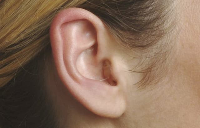 Acustica Martesana - Immagine 1