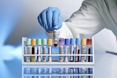 Antares - Immagine 1