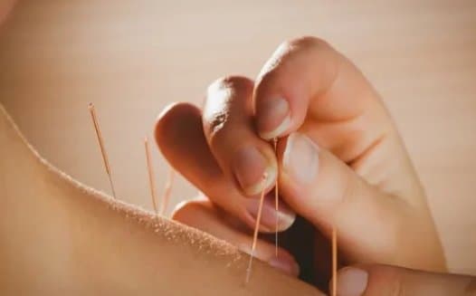 Fontanini Dr. Fulvio - Agopuntura - Immagine 2