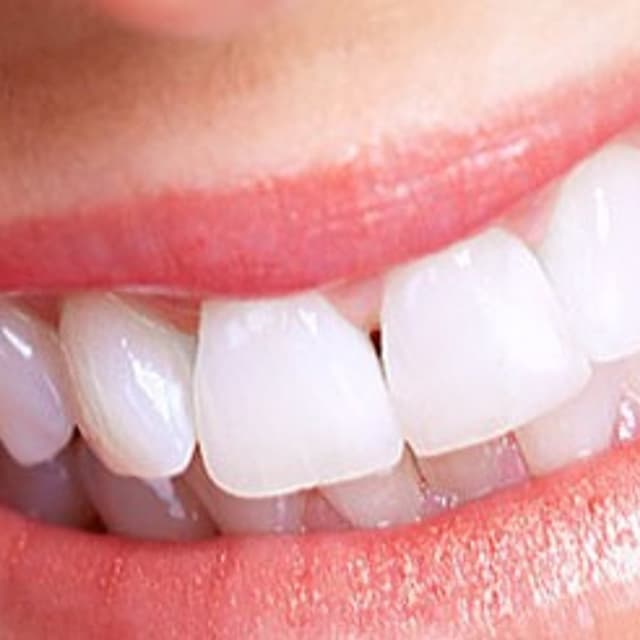 Laboratorio Odontotecnico Dentaltre - Immagine 1