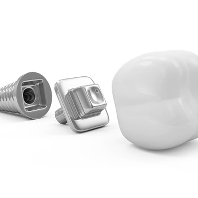 L'Odontotecnica - Immagine 2