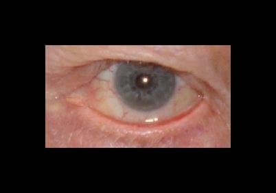 Burtolo Dr.ssa Carmen Medico Chirurgo - Spec. in Oftamologia e Chirurgia Oculare - Immagine 2