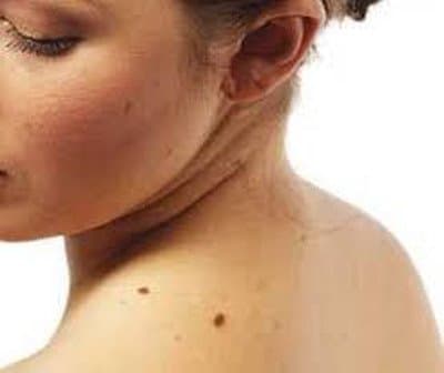 Cavaleri Dr. Marcello Dermatologo - Immagine 2