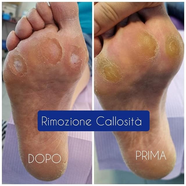 Centro per La Cura del Piede ( Podologia ) Dr.ssa Enrica Pagliari - Immagine 2