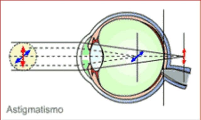 Dott. Edoardo Massera Oculista - Immagine 1