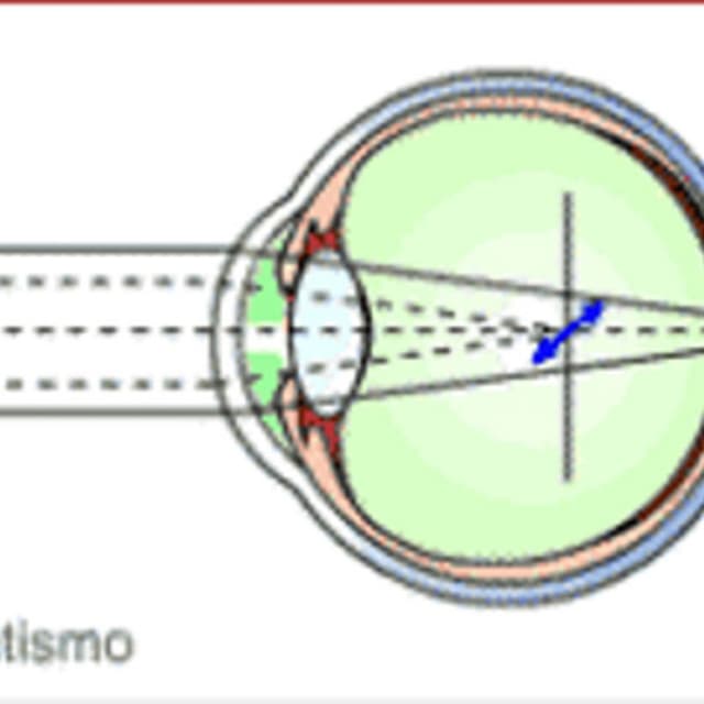 Dott. Edoardo Massera Oculista - Immagine 2