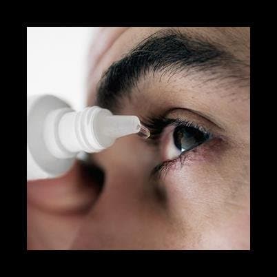 Occhialeria Zuckermann - Immagine 2