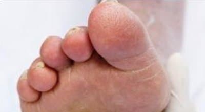 Podologo Fuschini Dott.ssa Paola - Immagine 1