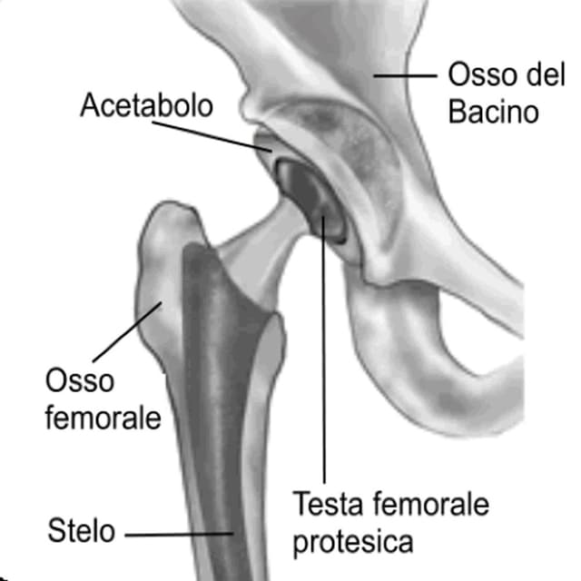 Sapienza Dr Salvatore Specialista in Ortopedia e Traumatologia - Immagine 2